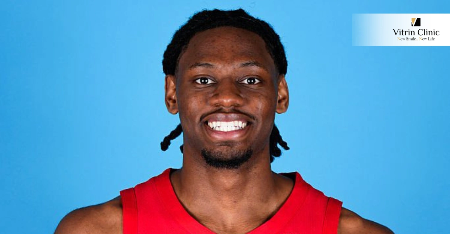 Jonathan Mogbo Smile Makeover: Revealing the NBA Star’s Perfect Smile